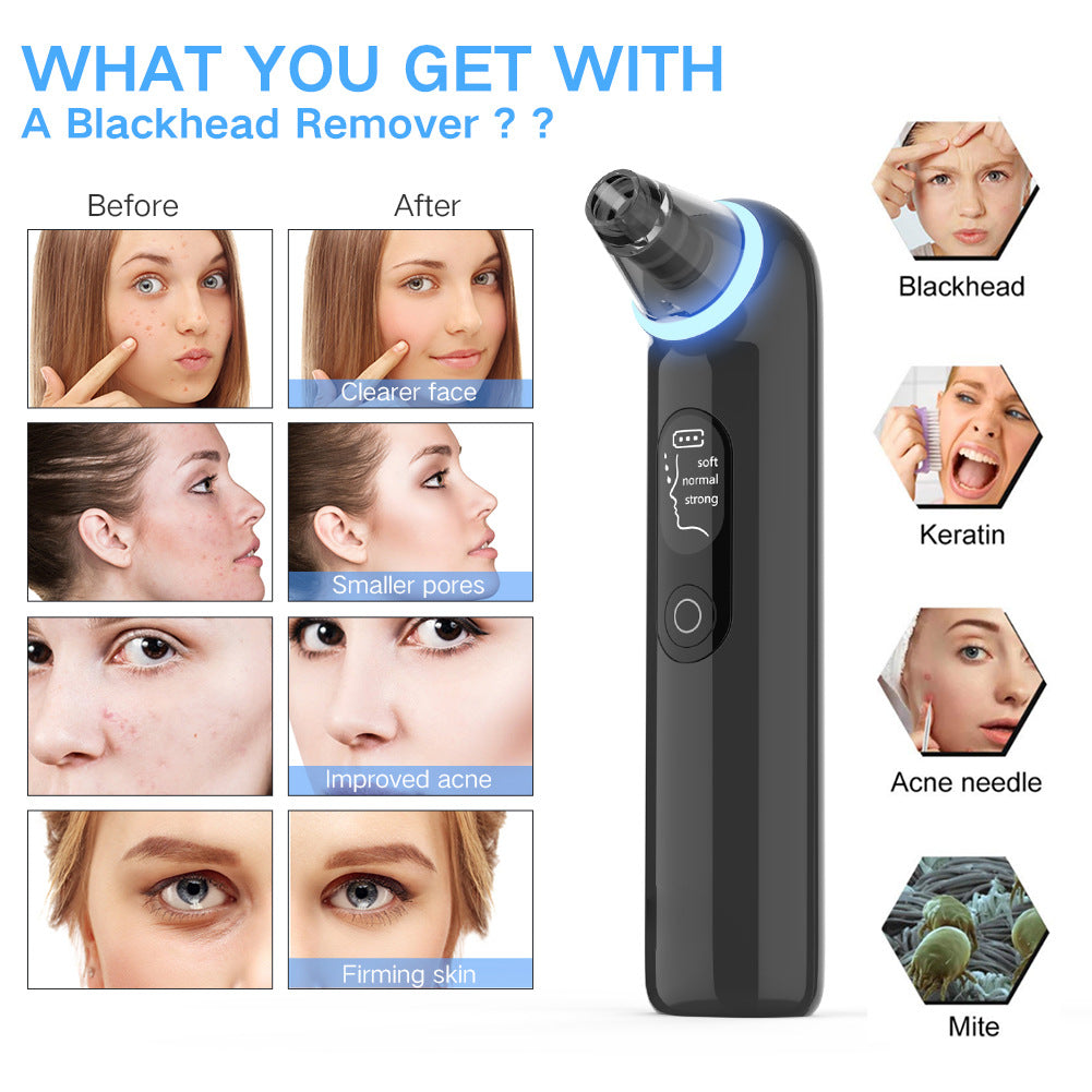 Electric Facial Pore Cleaner Vacuum Blackhead Remover